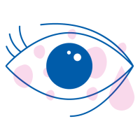 allergia