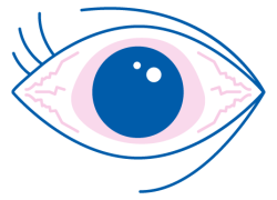 iridina spiega i sintomi degli occhi secchi e degli occhi impastati al mattino