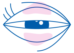 presbiopia