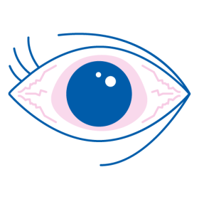 iridina sintomi occhi secchi