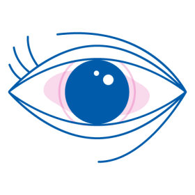 iridina sintomi occhi stanchi e occhi stressati
