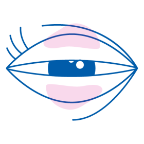presbiopia