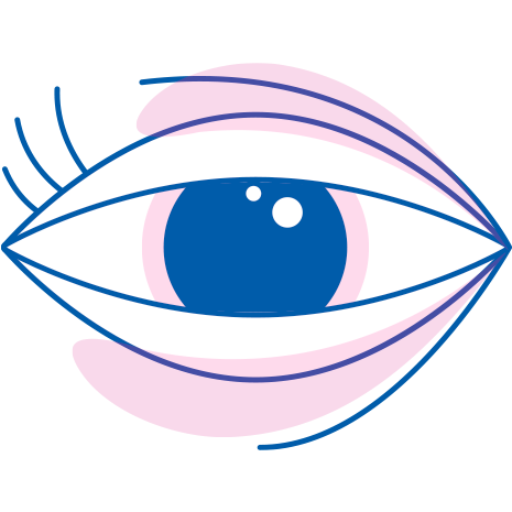 Iridina spiega i sintomi del bruciore oculare