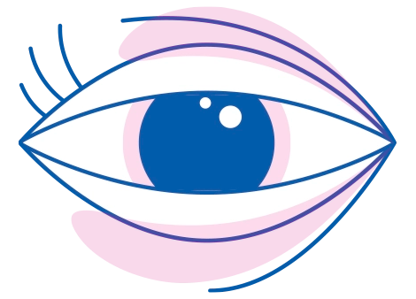 Occhi che bruciano e gonfi