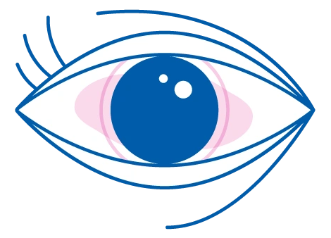 Occhi stanchi e stressati